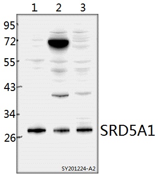 a03464 srd5a1 primary antiboties wb testing 1