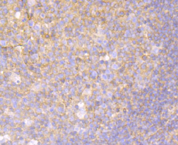 a03465 mgea5 primary antiboties ihc testing 2