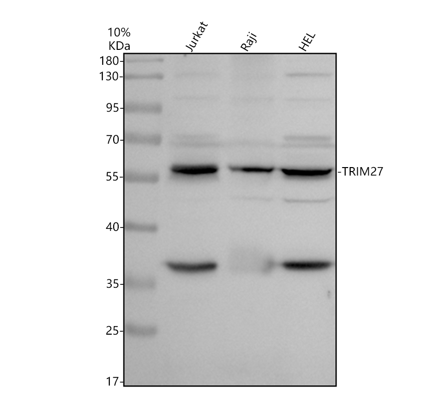 Western blot analysis of TRIM27 using anti-TRIM27 antibody (A03466-1)