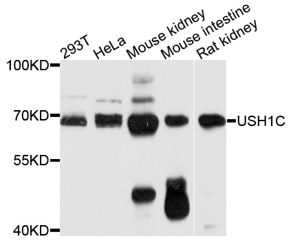 a03467 ush1c primary antiboties wb testing 1