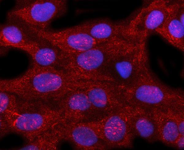  IF analysis of PIR using anti-PIR antibody (A03468-1)