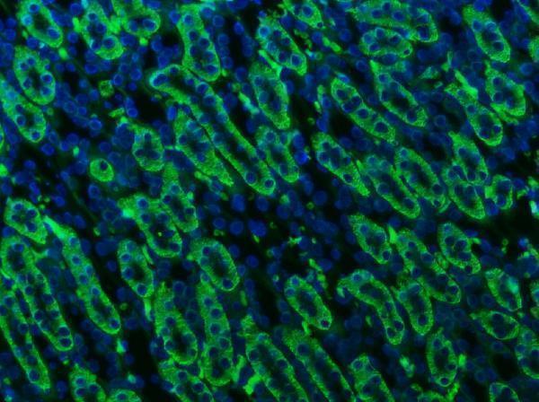 a03469 1 atp1b1 primary antibodies if testing 12