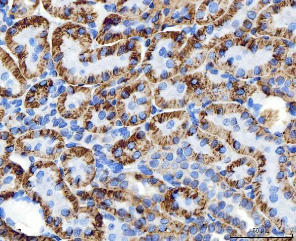 a03469 1 atp1b1 primary antibodies ihc testing 11