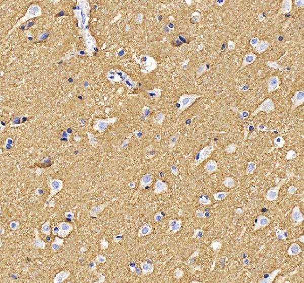 IHC analysis of ATP1B1 using anti-ATP1B1 antibody (A03469-1)