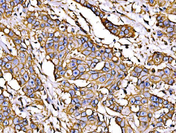  IHC analysis of ATP1B1 using anti-ATP1B1 antibody (A03469-1)