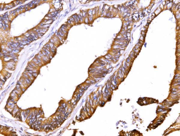 a03469 1 atp1b1 primary antibodies ihc testing 3