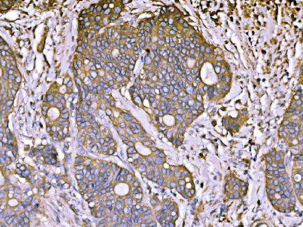a03469 1 atp1b1 primary antibodies ihc testing 4