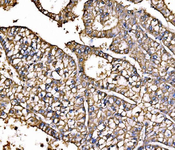 a03469 1 atp1b1 primary antibodies ihc testing 5