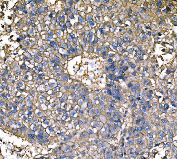 a03469 1 atp1b1 primary antibodies ihc testing 6