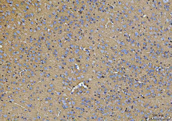 a03469 1 atp1b1 primary antibodies ihc testing 8