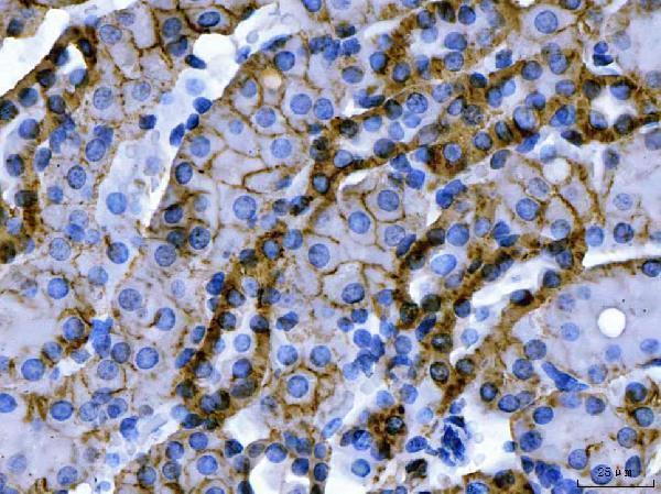 a03469 1 atp1b1 primary antibodies ihc testing 9