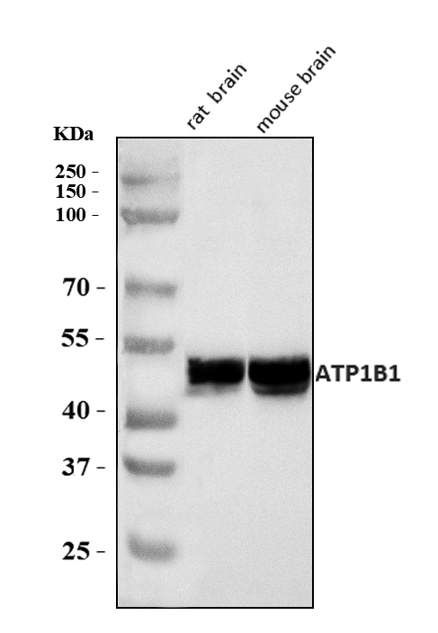  Western blot analysis of ATP1B1 using anti-ATP1B1 antibody (A03469-1)