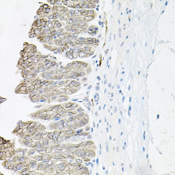 a03469 atp1b1 primary antiboties ihc testing 2