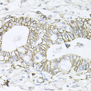 a03469 atp1b1 primary antiboties ihc testing 4