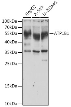 a03469 atp1b1 primary antiboties wb testing 1