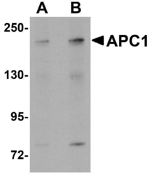 Western blot analysis of APC1 in SK-N-SH cell lysate with APC1 antibody at (A) 1 and (B) 2 μg/mL