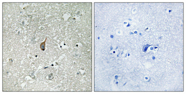 Immunohistochemistry validation of ANAPC1 using Anti-Phospho-APC1 (S355) ANAPC1 Antibody (A03471S355)