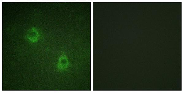 Immunofluorescence analysis of COS7 cells, using APC1 (Phospho-Ser688) Antibody