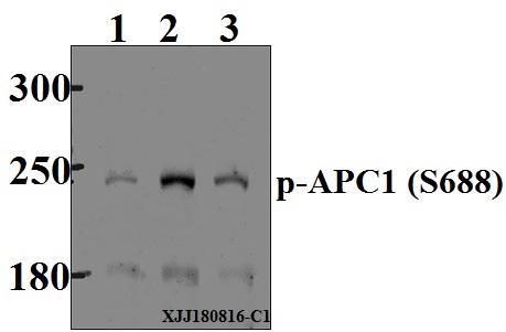 Western blot (WB) analysis of p-APC1 (S688) pAb at 1:500 dilution
Lane1:MCF-7 whole cell lysate(40µg)
Lane2:K562 whole cell lysate(40µg)
Lane3:HEK293T whole cell lysate(40µg)