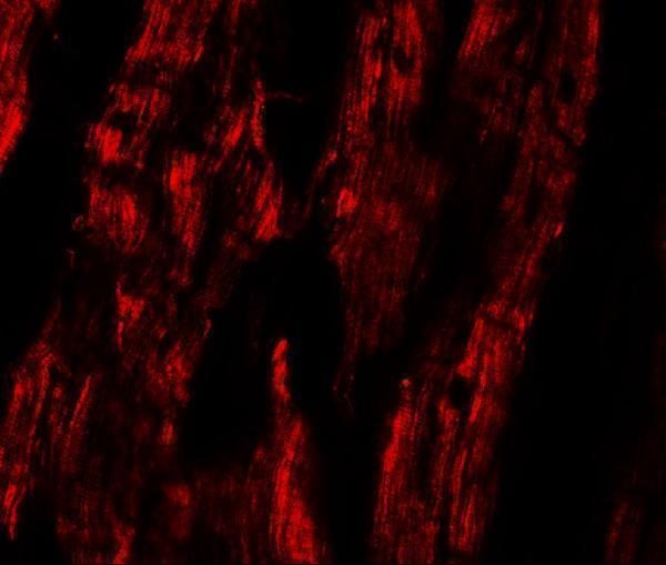 Immunofluorescence of ESRRB in human heart tissue with ESRRB antibody at 20 μg/mL