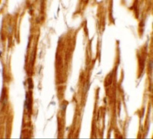 Immunohistochemistry of ESRR8 in human heart tissue with ESRR8 antibody at 5 μg/mL