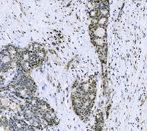  IHC analysis of CSNK2B using anti-CSNK2B antibody (A03475-1)