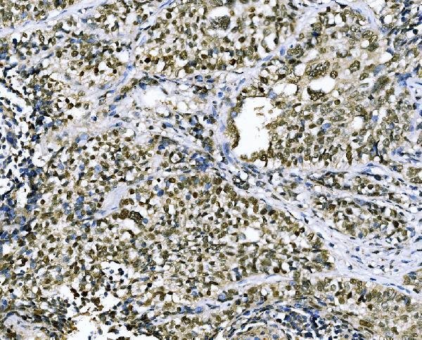 a03475 1 csnk2b primary antibodies ihc testing 4
