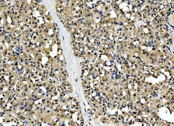 a03475 1 csnk2b primary antibodies ihc testing 5