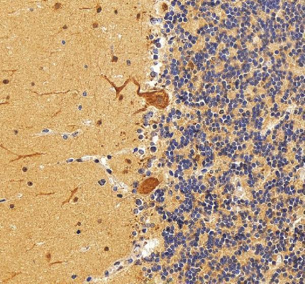 IHC analysis of CSNK2B using anti-CSNK2B antibody (A03475-1)