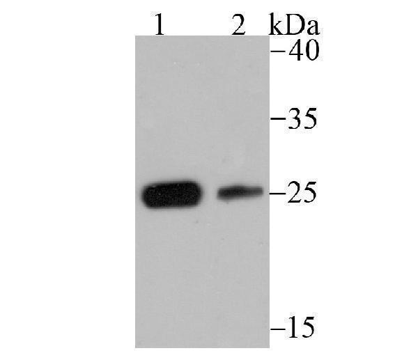 Western blot analysis of CSNK2B on SH-SY5Y (1) and 293 (2) lysate using anti-CSNK2B antibody at 1/500 dilution