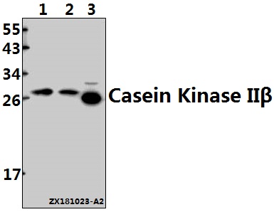 Western blot (WB) analysis of Casein Kinase IIβ (S205) pAb at 1:500 dilution
Lane1:HEK293 whole cell lysate(40ug)
Lane2:A2780 whole cell lysate(40ug)
Lane3:3T3-L1 whole cell lysate(20ug)