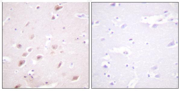 Immunohistochemistry analysis of paraffin-embedded human brain, using CKII-beta (Phospho-Ser209) Antibody