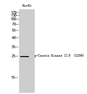 Western Blot analysis of HuvEc cells using Phospho-Casein Kinase IIβ (S209) Polyclonal Antibody