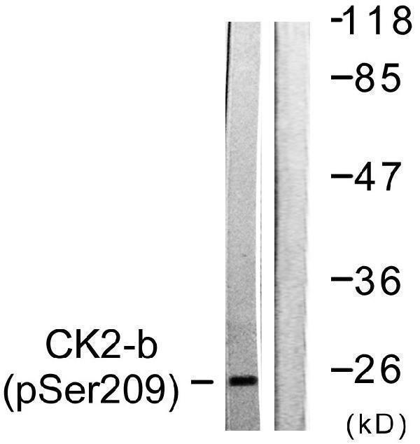 Western blot analysis of lysates from HUVEC cells, using CKII-beta (Phospho-Ser209) Antibody