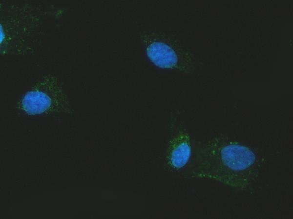 a03476 2 slc25a13 primary antibodies if testing 14