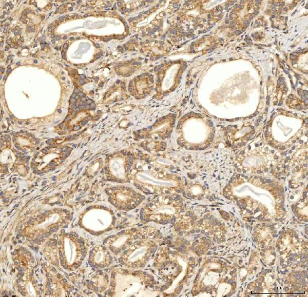a03476 2 slc25a13 primary antibodies ihc testing 10