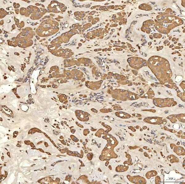 a03476 2 slc25a13 primary antibodies ihc testing 11