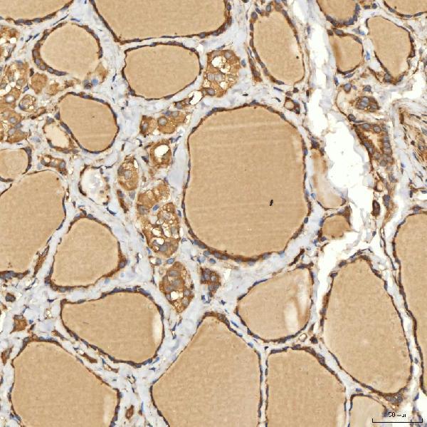 a03476 2 slc25a13 primary antibodies ihc testing 12