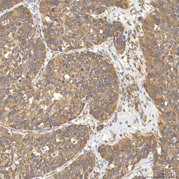 a03476 2 slc25a13 primary antibodies ihc testing 13