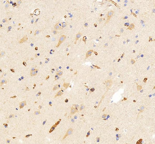 IHC analysis of SLC25A13 using anti-SLC25A13 antibody (A03476-2)