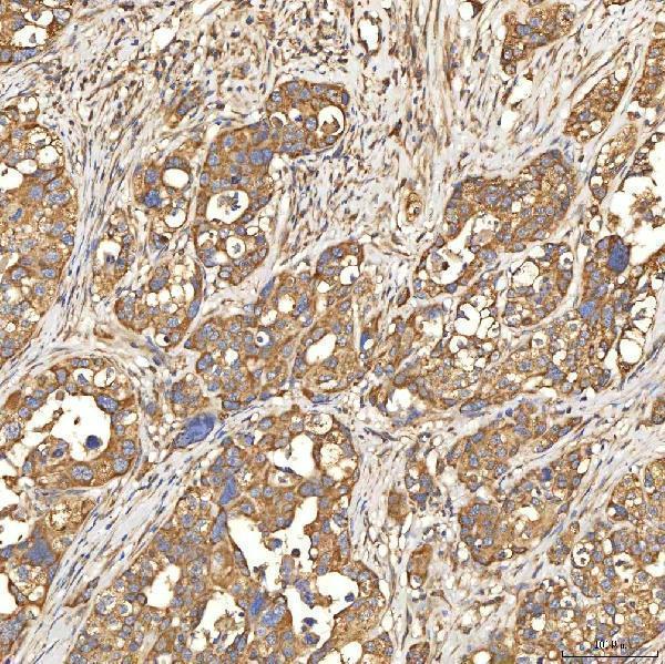  IHC analysis of Citrin/SLC25A13 using anti-Citrin/SLC25A13 antibody (A03476-2)
