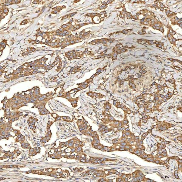 a03476 2 slc25a13 primary antibodies ihc testing 3