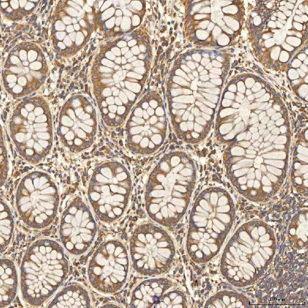 a03476 2 slc25a13 primary antibodies ihc testing 4