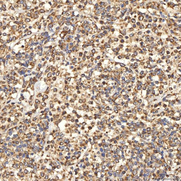 a03476 2 slc25a13 primary antibodies ihc testing 5