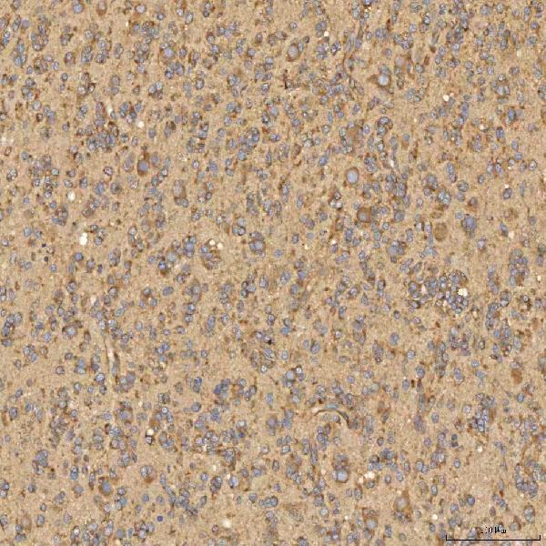 a03476 2 slc25a13 primary antibodies ihc testing 6