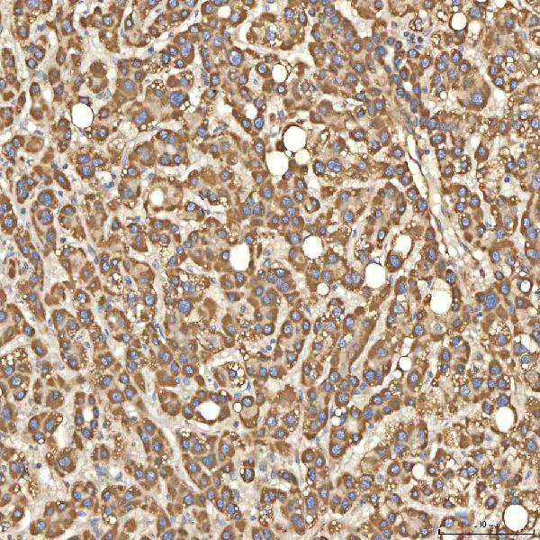 a03476 2 slc25a13 primary antibodies ihc testing 7