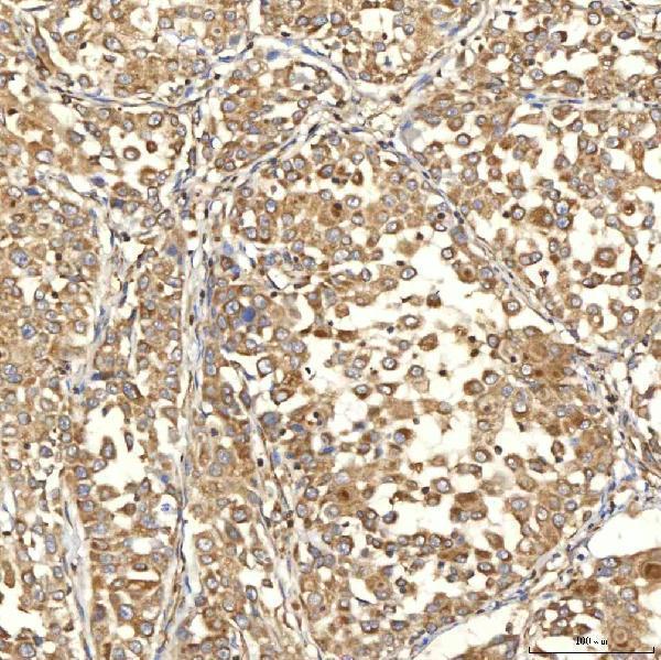a03476 2 slc25a13 primary antibodies ihc testing 8