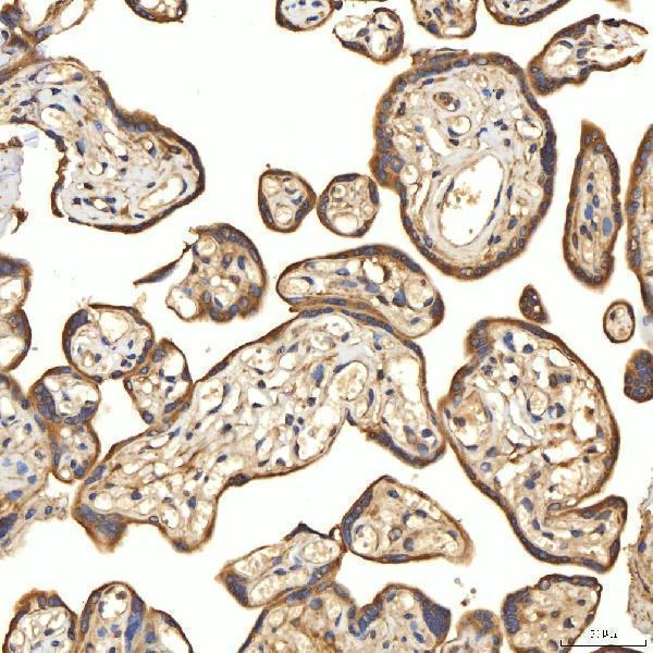 a03476 2 slc25a13 primary antibodies ihc testing 9