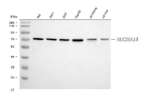  Western blot analysis of Citrin/SLC25A13 using anti-Citrin/SLC25A13 antibody (A03476-2)