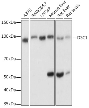 Western blot analysis of extracts of various cell lines, using DSC1 antibody  at 1:1000 dilution